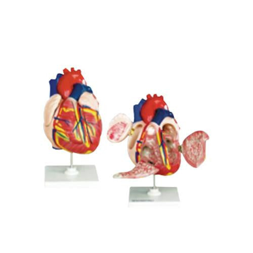 Corazón Mediano. Modelo CVQ7010